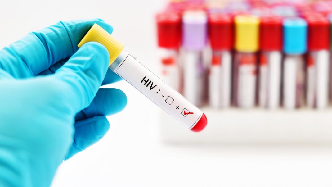STD/HIV testing